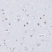Anti-RPF2 antibody produced in rabbit 