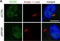 Anti-RPGR antibody produced in rabbit 