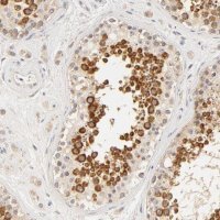 Anti-RPGR antibody produced in rabbit 