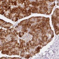Anti-RPL10A antibody produced in rabbit HPA053803-100UL