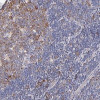 Anti-RPL30 antibody produced in rabbit HPA002651-100UL