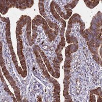 Anti-RPL36 antibody produced in rabbit HPA047153-100UL