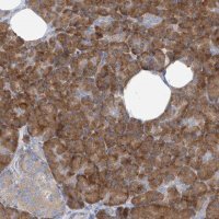 Anti-RPL4 antibody produced in rabbit 