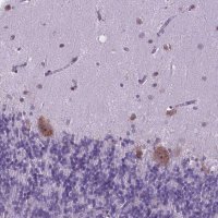 Anti-RPL6 antibody produced in rabbit HPA068418-100UL