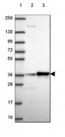 Anti-RPL6 antibody produced in rabbit HPA068418-100UL