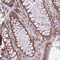 Anti-RPL7 antibody produced in rabbit HPA058373-100UL