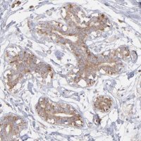 Anti-RPLP0 antibody produced in rabbit 