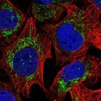 Anti-RPLP2 antibody produced in rabbit