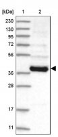 Anti-RPP40 antibody produced in rabbit