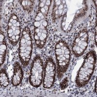 Anti-RPRD1A antibody produced in rabbit 