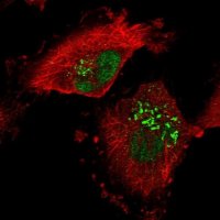 Anti-RPRD1A antibody produced in rabbit 