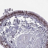 Anti-RPRD2 antibody produced in rabbit 