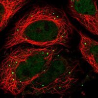 Anti-RPRD2 antibody produced in rabbit 
