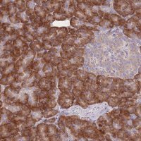 Anti-RPS10 antibody produced in rabbit 