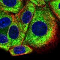 Anti-RPS10 antibody produced in rabbit HPA048084-100UL