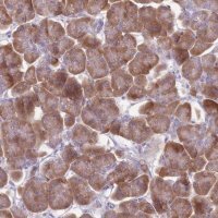 Anti-RPS11 antibody produced in rabbit HPA049719-100UL