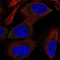 Anti-RPS12 antibody produced in rabbit HPA006365-100UL