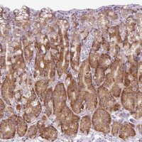Anti-RPS23 antibody produced in rabbit HPA054853-100UL