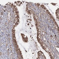 Anti-RPS25 antibody produced in rabbit 