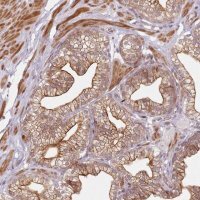 Anti-RPS6KA2 antibody produced in rabbit 