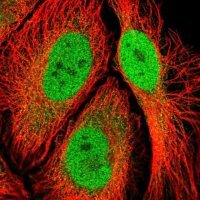 Anti-RPS6KA2 antibody produced in rabbit 