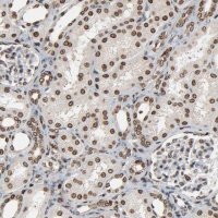 Anti-RPS6KA3 antibody produced in rabbit 