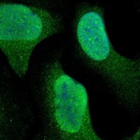 Anti-RPS6KA3 antibody produced in rabbit 