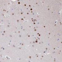 Anti-RPS6KA5 antibody produced in rabbit HPA001274-100UL