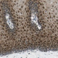 Anti-RPS6KB2 antibody produced in rabbit