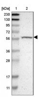Anti-RPS6KB2 antibody produced in rabbit