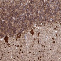 Anti-RPS7 antibody produced in rabbit HPA056586-100UL