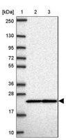 Anti-RPS7 antibody produced in rabbit HPA056586-100UL