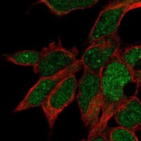 Anti-RPUSD3 antibody produced in rabbit 