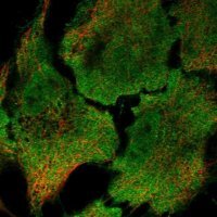 Anti-RRAD antibody produced in rabbit 