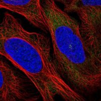 Anti-RRM1 antibody produced in rabbit