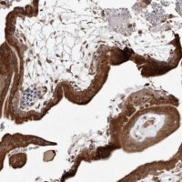 Anti-RRM2B antibody produced in rabbit