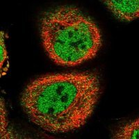 Anti-RRM2B antibody produced in rabbit