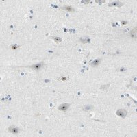Anti-RRP1 antibody produced in rabbit 