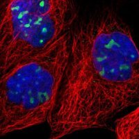 Anti-RRP1 antibody produced in rabbit 