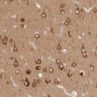 Anti-RRP15 antibody produced in rabbit 