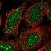 Anti-RRP8 antibody produced in rabbit HPA057562-100UL