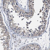 Anti-RSBN1L antibody produced in rabbit