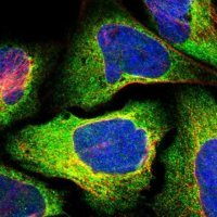 Anti-RTN4 antibody produced in rabbit 