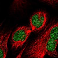 Anti-RUFY2 antibody produced in rabbit