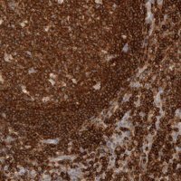 Anti-RUNDC1 antibody produced in rabbit 