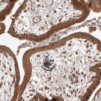 Anti-RWDD1 antibody produced in rabbit 