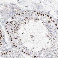 Anti-SAGE1 antibody produced in rabbit