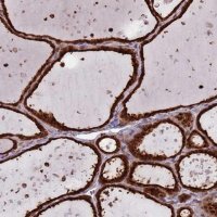 Anti-SALL1 antibody produced in rabbit 