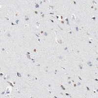Anti-SALL2 antibody produced in rabbit 