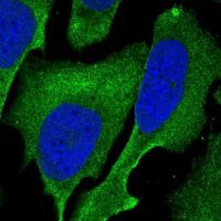 Anti-SAMD1 antibody produced in rabbit 